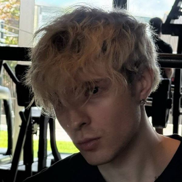 Егор Крид получил травму в Дубае